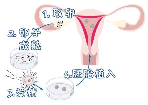 关于素竹生殖